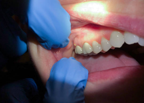 Best Emergency Cosmetic Dentistry in Shady Point, OK