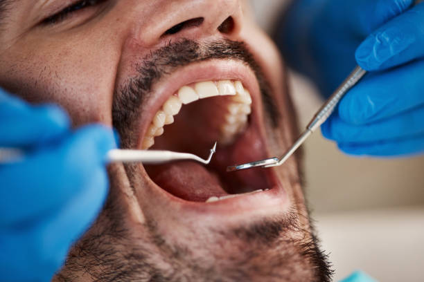 Best Emergency Dentist for Special Needs Patients in Shady Point, OK