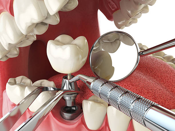 Best Emergency Dentist for Lost Fillings or Crowns in Shady Point, OK